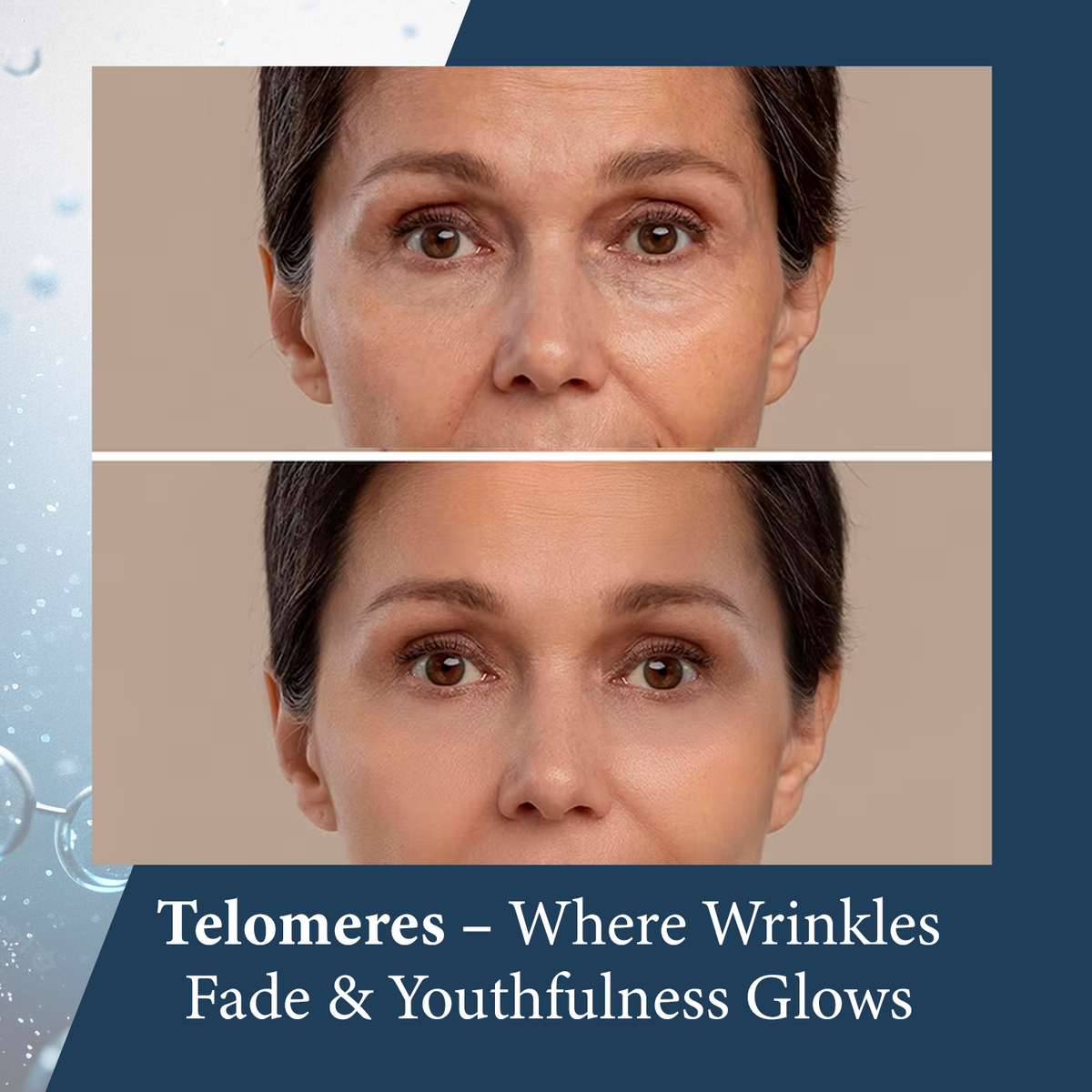 Elite Telomere Night Cream