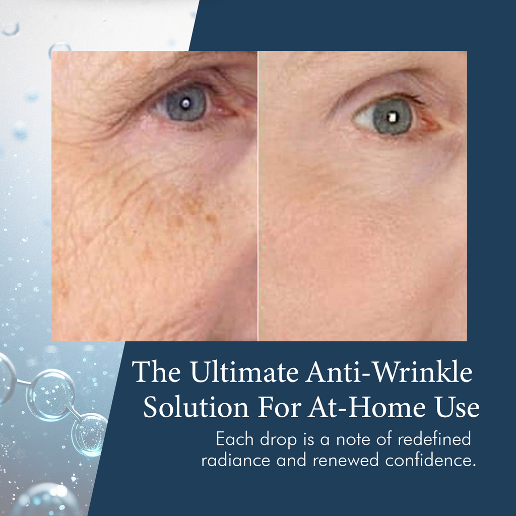 SkinPro 3% Retinol Complex Facial Serum