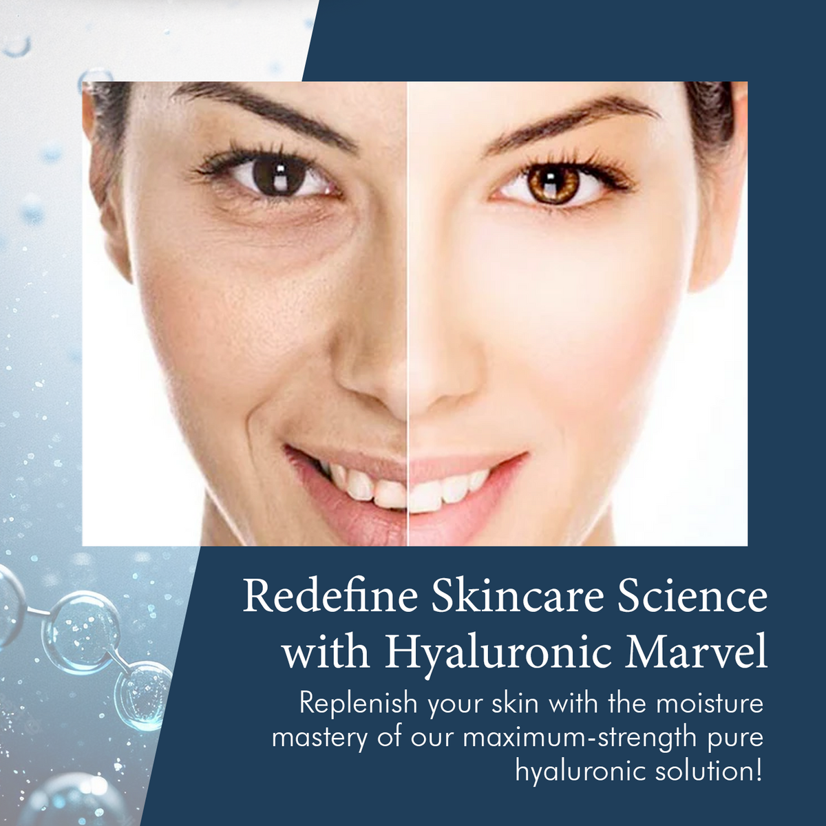 Delfogo Rx Hyaluronic Acid Moisturizing Cream