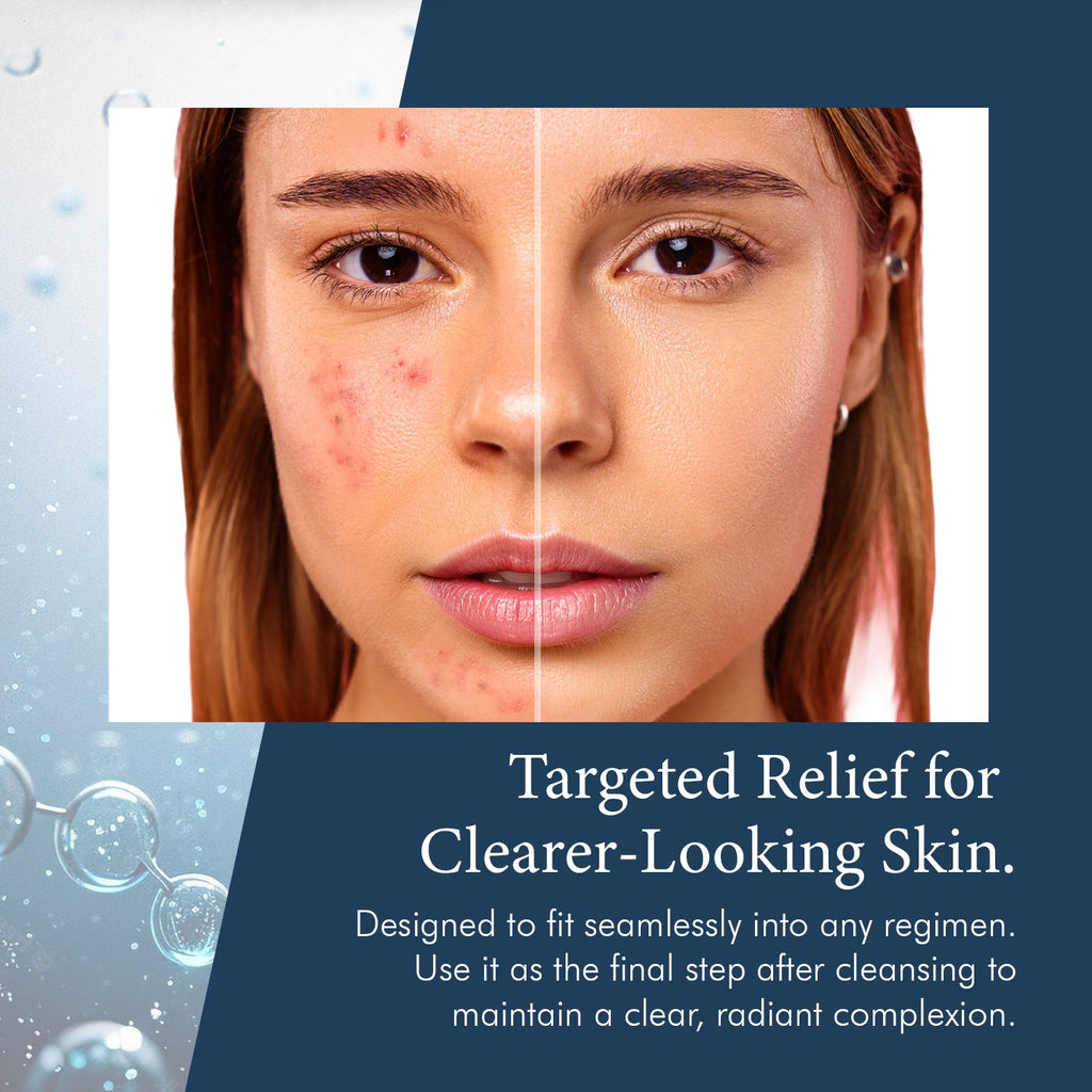 SkinPro 911 Clarifying Facial Treatment